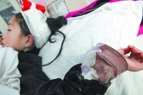 鑫鑫內(nèi)衣袖子上的血跡清晰可見(jiàn)