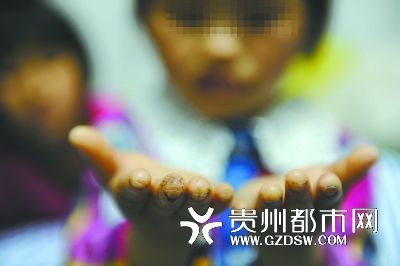 指尖被針扎得傷痕累累。