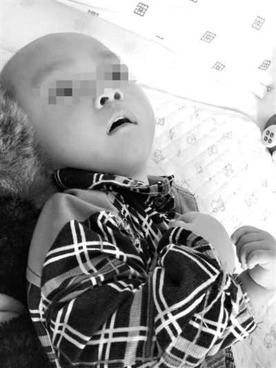 9月10日，陳揚(yáng)躺在醫(yī)院的病床上，他的眼睛仍然沒(méi)有聚焦感。新京報(bào)記者 朱柳笛 攝