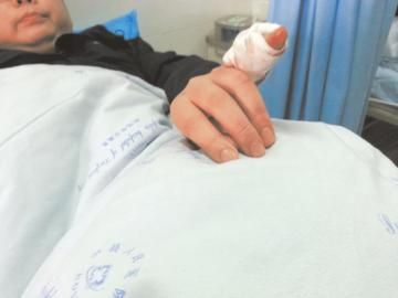 實習(xí)醫(yī)生陳洪左手的小拇指肌腱斷裂。