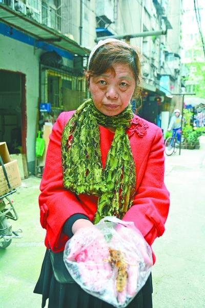 頭部受傷的黃女士展示兩根大魚刺。