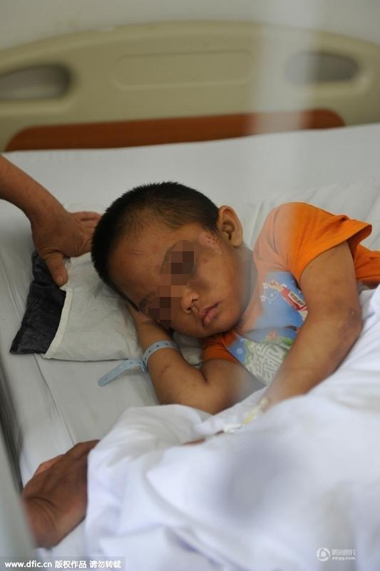 圖為全身傷痕累累的小進(jìn)。