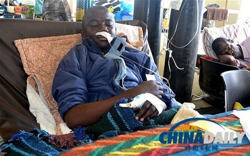 雖然已經(jīng)在醫(yī)院接受了近一個月的恢復(fù)治療，卡托卡的身體仍然非常虛弱。