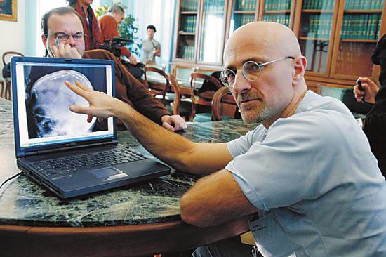 圖為卡納維洛醫(yī)生，不少人認(rèn)為他的想法非常瘋狂