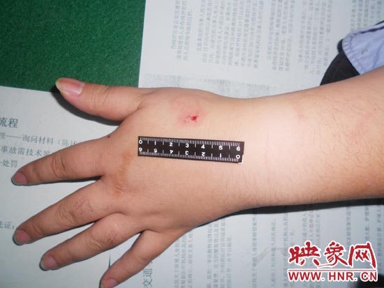 為幫助無(wú)證駕駛的朋友逃避處罰，新鄉(xiāng)的王某竟對(duì)執(zhí)勤民警大打出手，還將一名民警的手臂咬傷