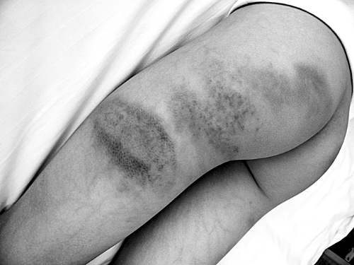 老師持掃帚打?qū)W生30分鐘 一個(gè)班20個(gè)同學(xué)被打過