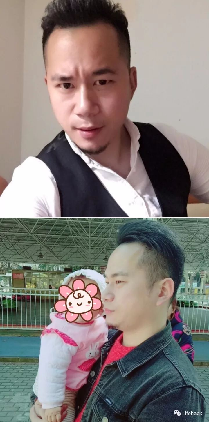 長胖20斤，臉型怎么變？這些例子看完扎心了！