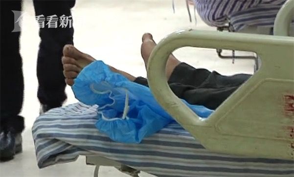 黃鱔從肛門鉆進(jìn)肚子 男子被送醫(yī)不愿多談事情經(jīng)過(guò)