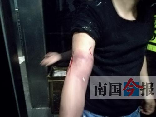 覃先生手臂被卡的部位受傷流血，所幸傷勢無大礙。 通訊員 王建民 攝