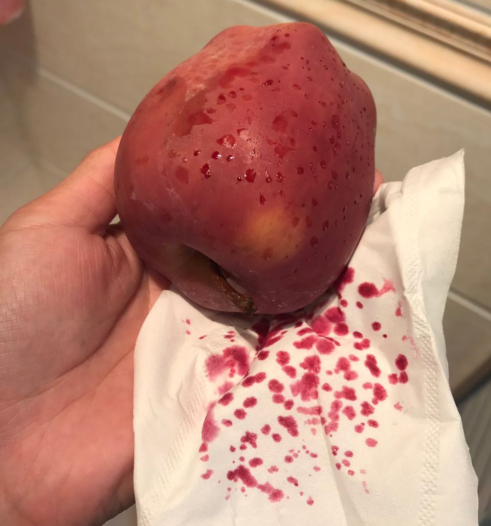 嚇懵！女子用熱水泡蘋果結(jié)果冒出血珠 咋回事？