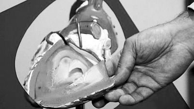 威廉斯領(lǐng)導(dǎo)的研究團(tuán)隊(duì)已經(jīng)利用人體脂肪干細(xì)胞，成功3D打印出心臟血管和心臟瓣膜，待一顆心臟的所有部件打