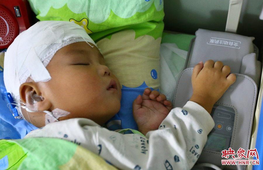 經(jīng)過手術，小龍病情已經(jīng)逐漸好轉，正在甜甜的熟睡