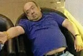 網(wǎng)傳金正男中毒后的照片。