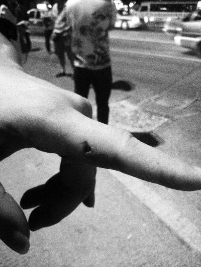 民警食指被咬傷。