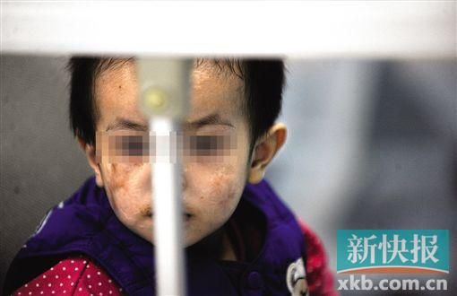 去年3月就能出院的小華(化名),目前還在廣州市婦兒醫(yī)療中心的PICU里住著。新快報(bào)記者 孫毅/攝