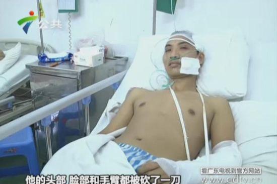 另一名傷者頭部、臉部和手臂都被砍了一刀。(視頻截圖)