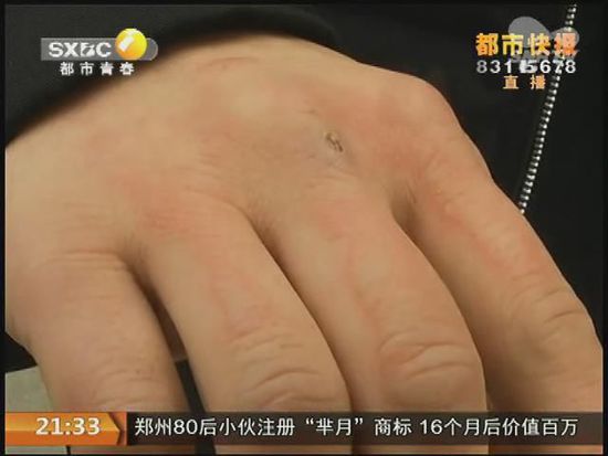 說到這足療拔罐，估計大伙都不陌生，但是想起4號晚上的拔罐的經(jīng)歷，呂先生現(xiàn)在想起來，還心有余悸。
