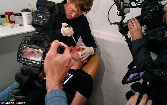 該實驗是由加州一支名為“生物駭客”的實驗團隊開展的。他們使用了一種名為二氫卟吩e6（Ce6）的物質的溶液。Ce6常見于深海魚體內，有光敏特性，通常用于癌癥治療研究中。研究團隊將Ce6與胰島素和鹽水混合起來，得到一種溶液，可以在低光照條件下提高人類的視力。