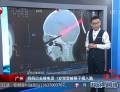 媽媽出去接電話(huà) 1歲寶寶被筷子插入腦