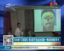 19小時 12名醫(yī)生 河北男子完成全球第一例自體換臉手術(shù)
