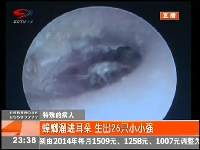 小強(qiáng)溜進(jìn)耳朵？生26只小小強(qiáng)