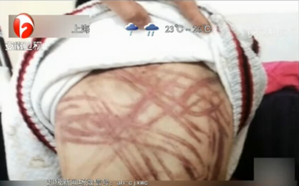 “虐童案”開庭 養(yǎng)母堅(jiān)稱無(wú)罪