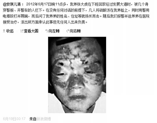 男子拒盤查遭潑辣椒水毀容 警方稱或?qū)龠^敏